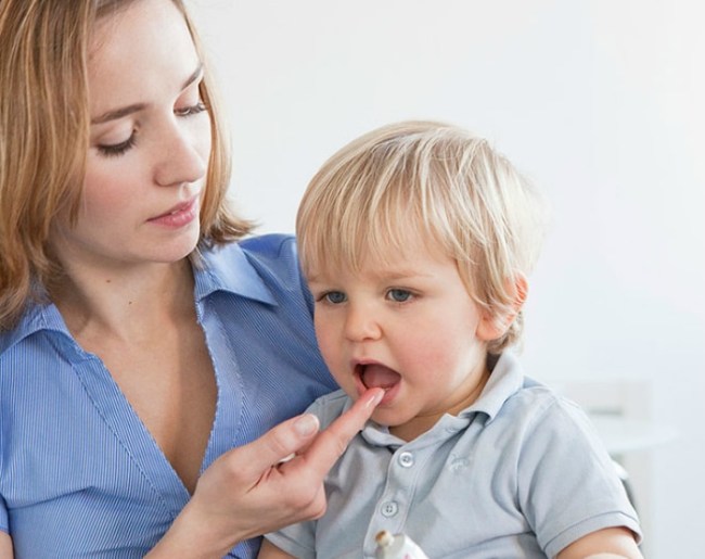 Калгель можно наносить на воспаленные десна не более 6-ти раз в сутки