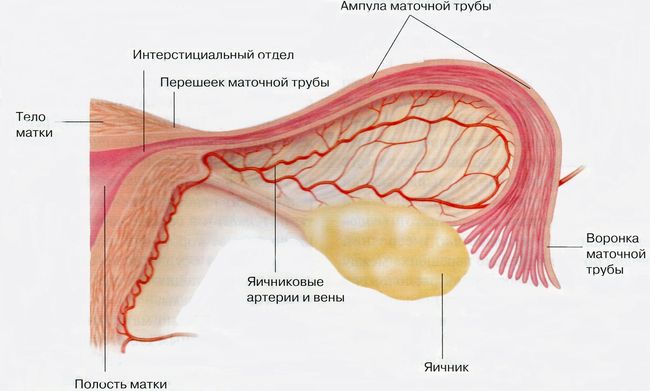 Заболевания поражающие маточные трубы и яичники называют воспаление придатков
